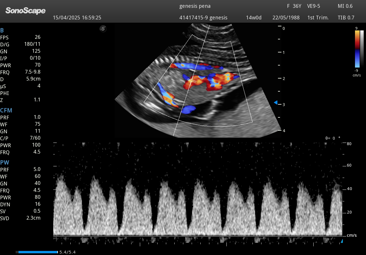Ecografía Doppler flujo uterino embarazo