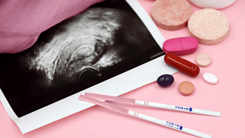 Factores comunes que afectan negativamente el microbioma vaginal.